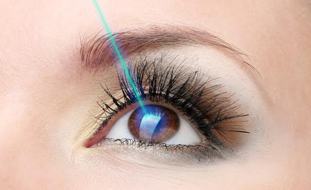 phẫu thuật mắt lasik
