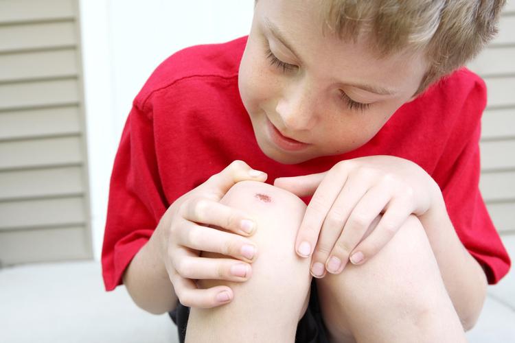 5 dấu hiệu nhiễm trùng vết thương và cách xử trí khoa học, an toàn