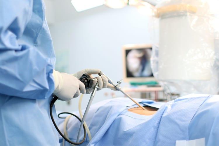 Phẫu thuật nội soi cho các bệnh về đường tiêu hóa