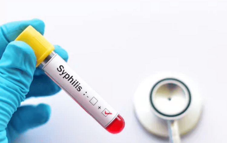 Bệnh giang mai có chữa được không?