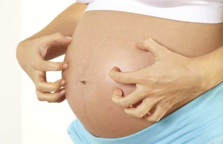 bị ngứa da vào ban đêm khi mang thai
