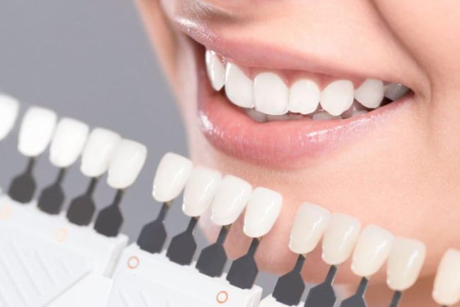 Tẩy trắng răng có tốt không? Ưu, nhược điểm của từng biện pháp tẩy răng
