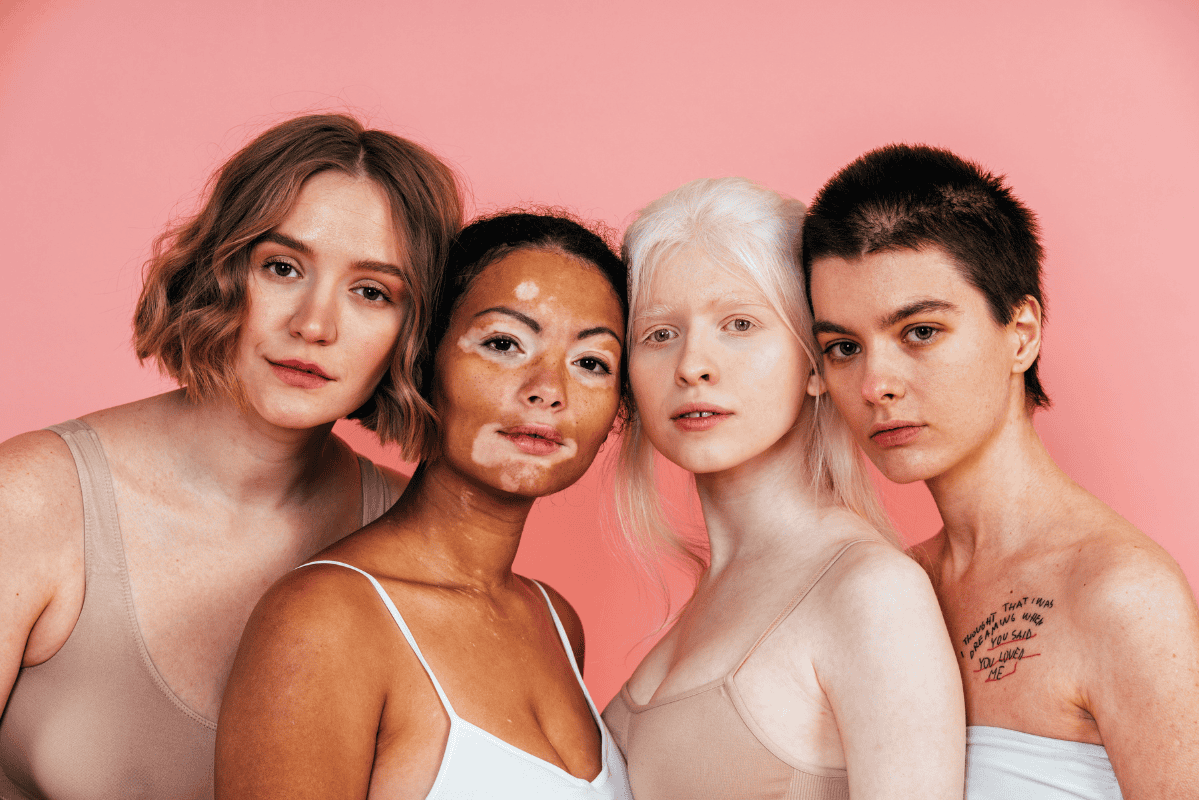 Body shaming là gì? Tưởng là đùa nhưng để lại hậu quả nghiêm trọng