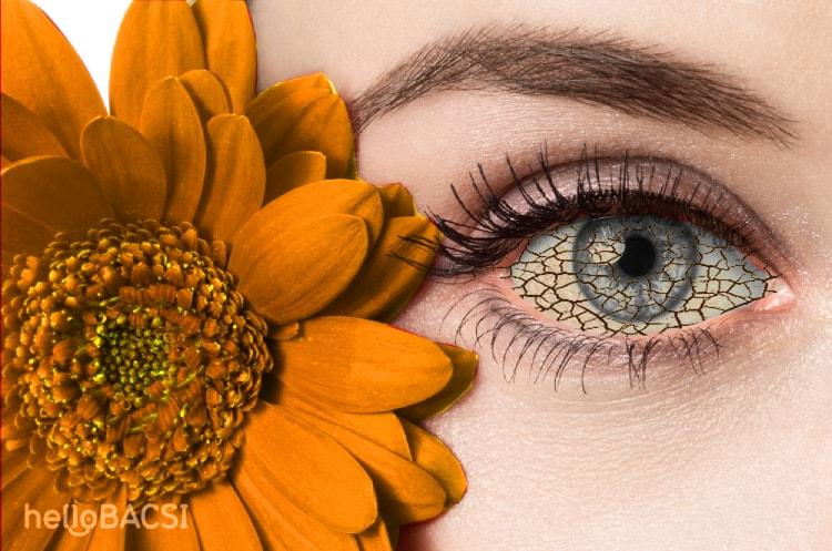 Bật mí 7 phương pháp giúp chữa khô mắt hiệu quả