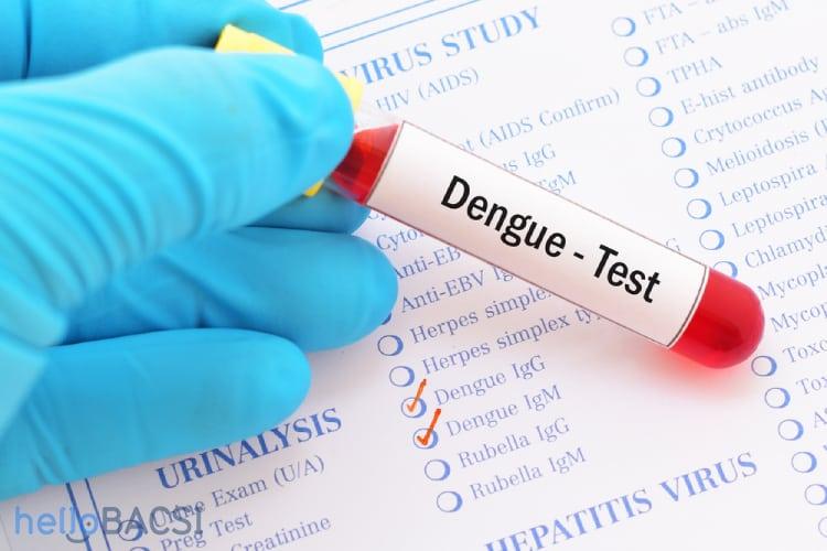 Xét nghiệm sốt xuất huyết