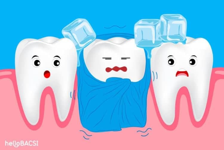 Giải đáp thắc mắc: Đau nhức răng báo hiệu điều gì, cách điều trị hiệu quả
