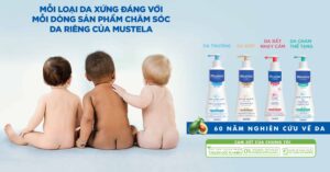 Trẻ sơ sinh bị chàm
