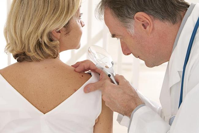 8 dấu hiệu ung thư da: Nhận biết để điều trị kịp thời