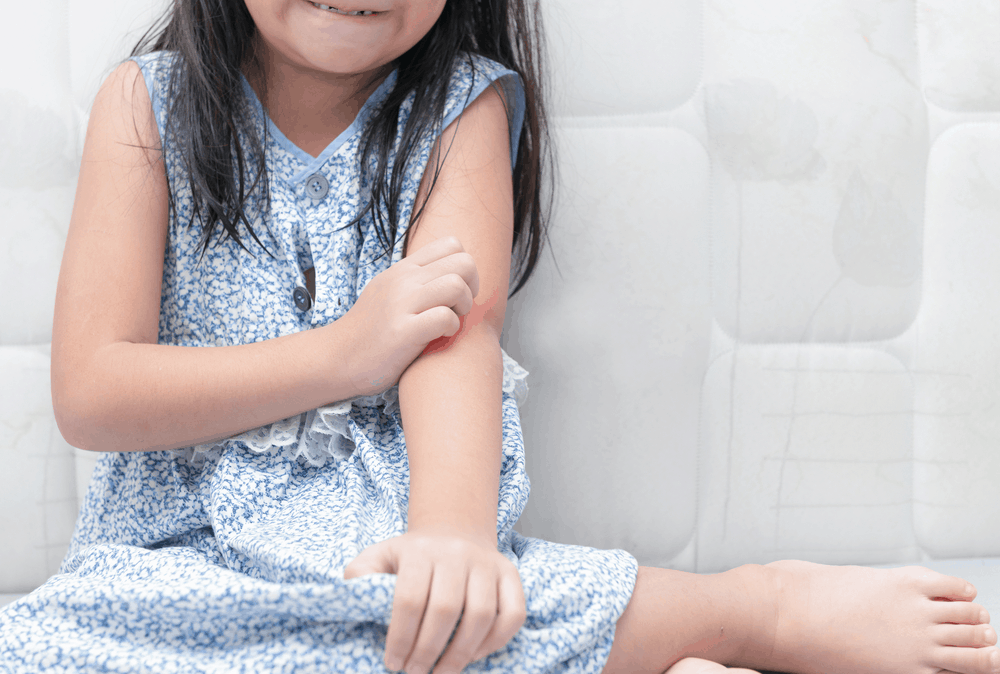Cách xử lý khi bé bị hăm da