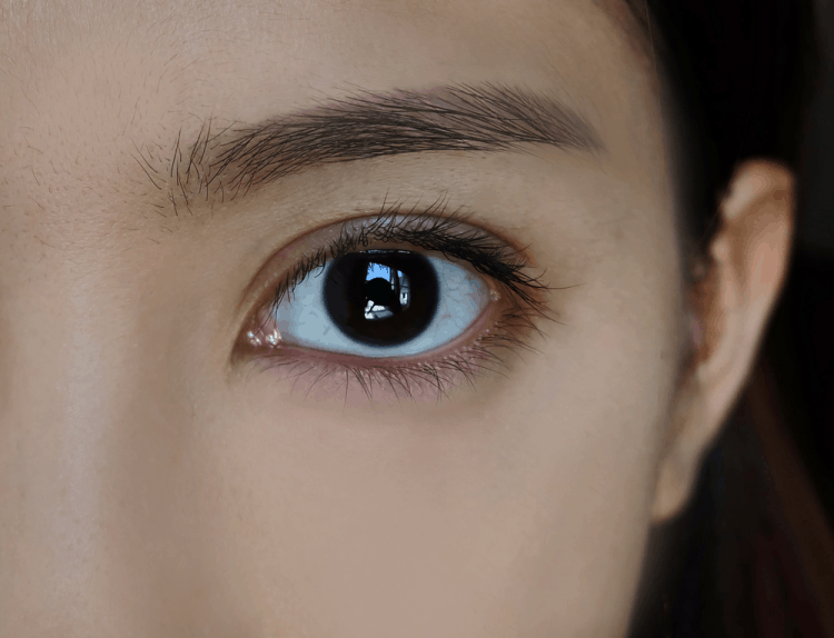 Zona thần kinh ở mắt và những điều liên quan