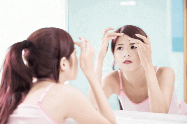 Mụn cám ở trán: Nguyên nhân và cách khắc phục