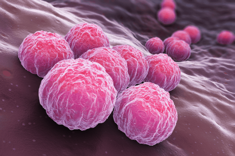 Bệnh chlamydia kiêng gì? 3 nhóm thực phẩm nên tránh