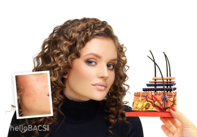 Mách bạn cách thu nhỏ vết sẹo