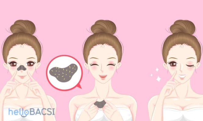  có nên lột mụn ko 