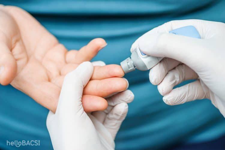 dấu hiệu hiv ở nam