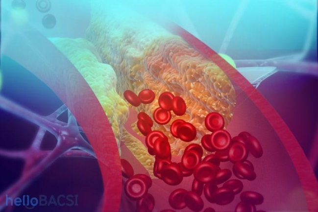 Thiếu oxy: Triệu chứng, nguyên nhân và cách điều trị