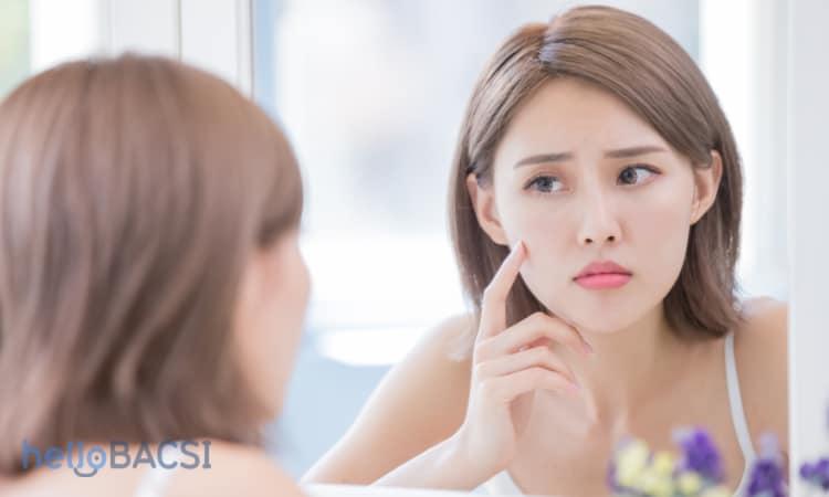 Có nên nặn mụn đầu đen không?
