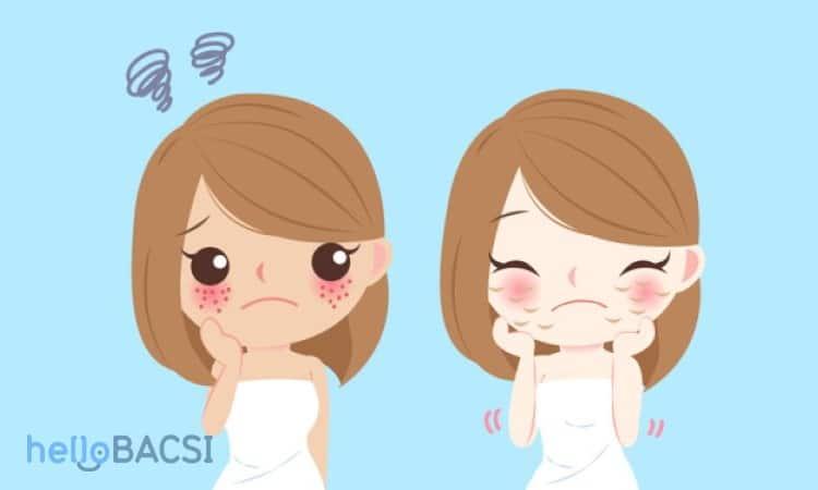 Dấu hiệu 3: Da nhạy cảm thường xuyên bị ngứa