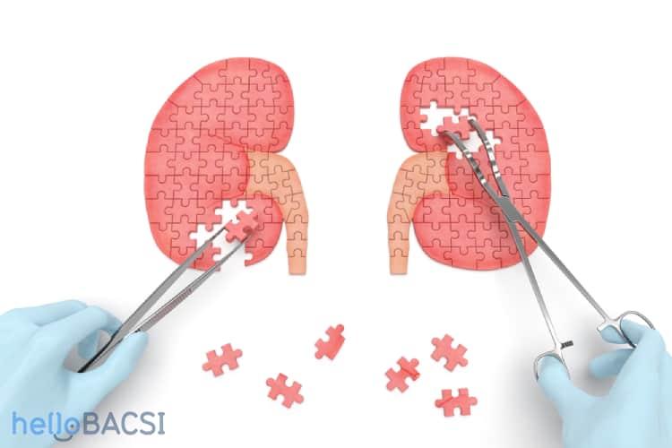 Điều trị suy thận và những điều bạn nên biết