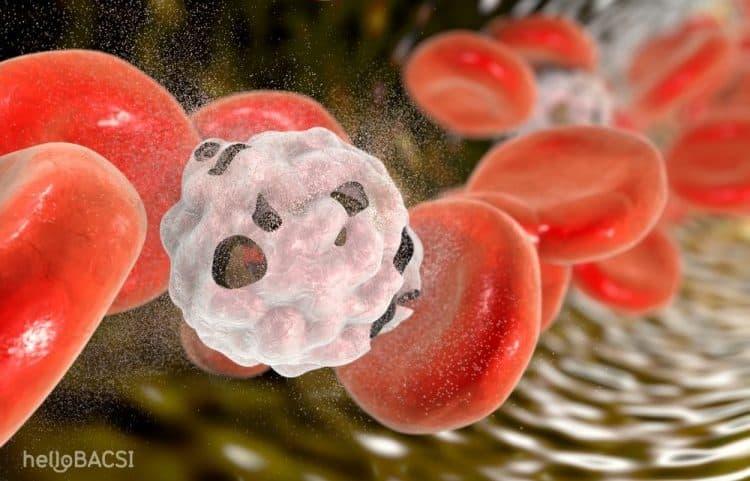 Bệnh thiếu máu nhược sắc