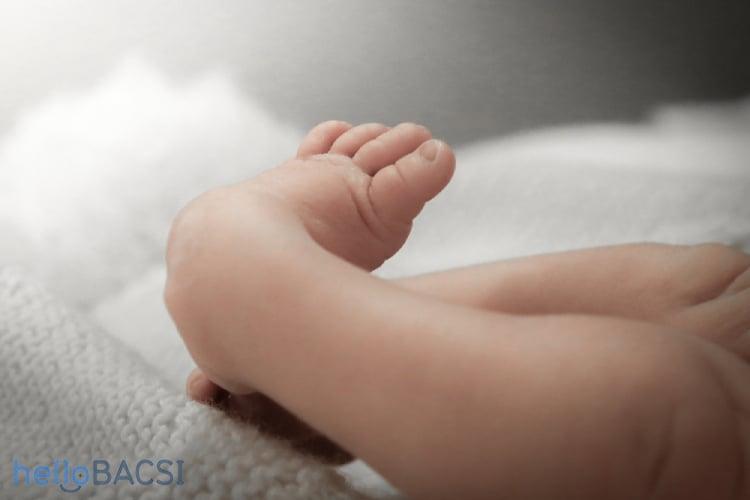 Khoèo chân bẩm sinh