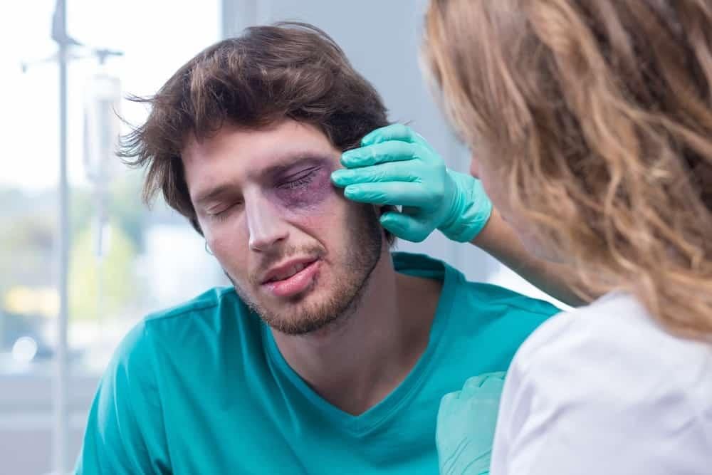 4 cách làm tan máu bầm ở mắt tại nhà đơn giản và hiệu quả