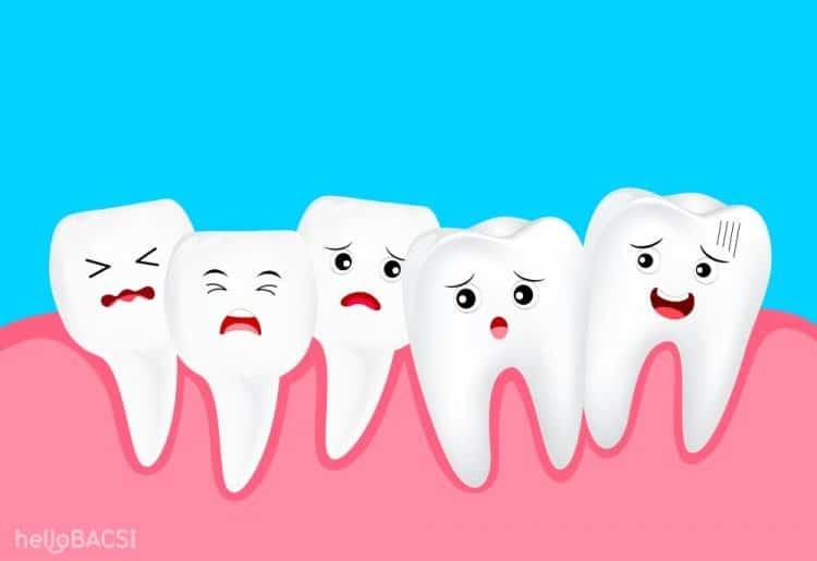 Răng không đều: Hãy đi chỉnh nha để tự tin hơn