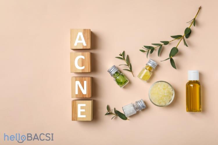 Mách nhỏ 9 loại tinh dầu trị mụn bạn không nên bỏ qua