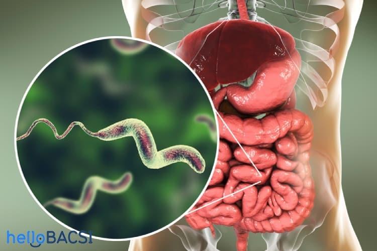 Dấu hiệu nhiễm vi khuẩn campylobacter - Điều trị, phòng ngừa ra sao?