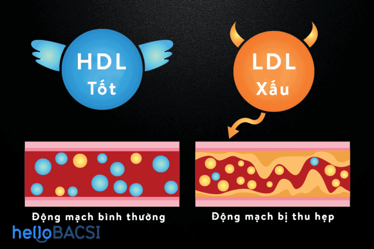 Phân biệt cholesterol tốt và xấu
