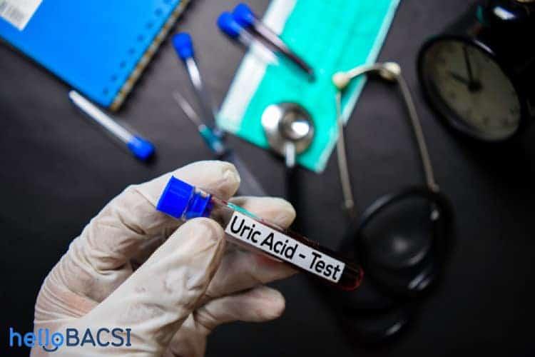 Định lượng axit uric