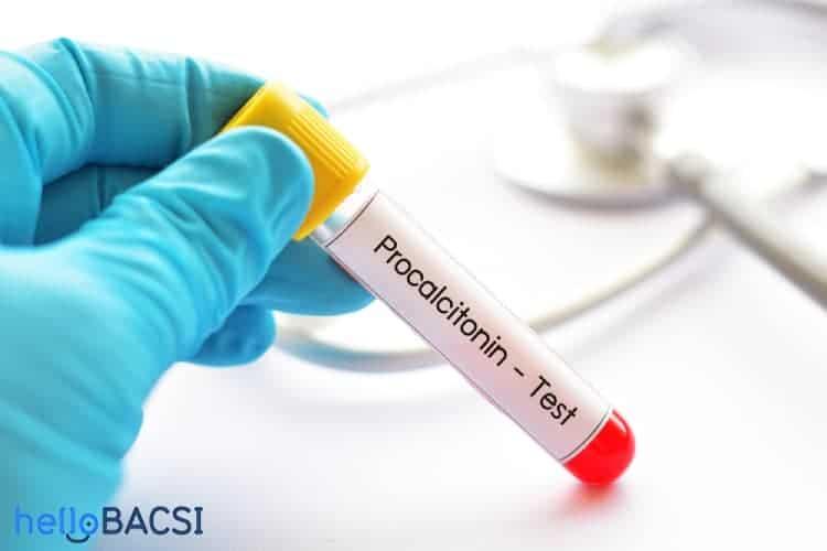 Định lượng procalcitonin (PCT)