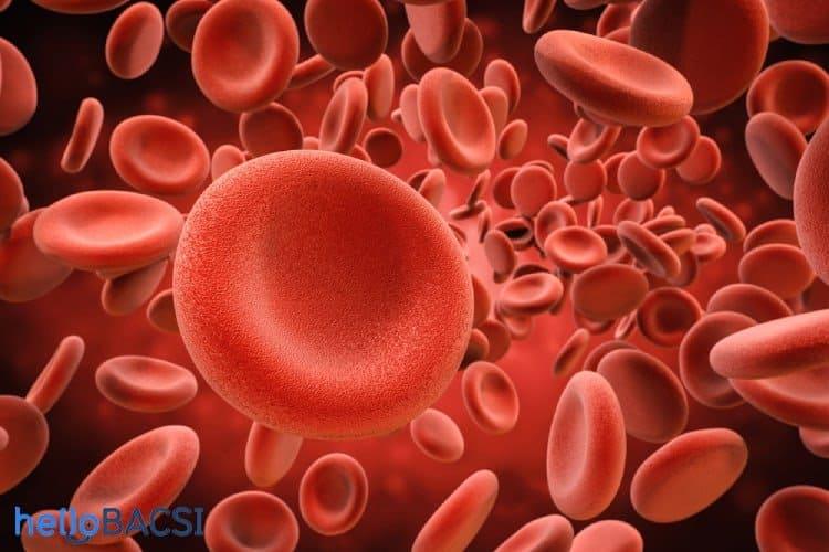 Hemoglobin niệu về đêm kịch phát
