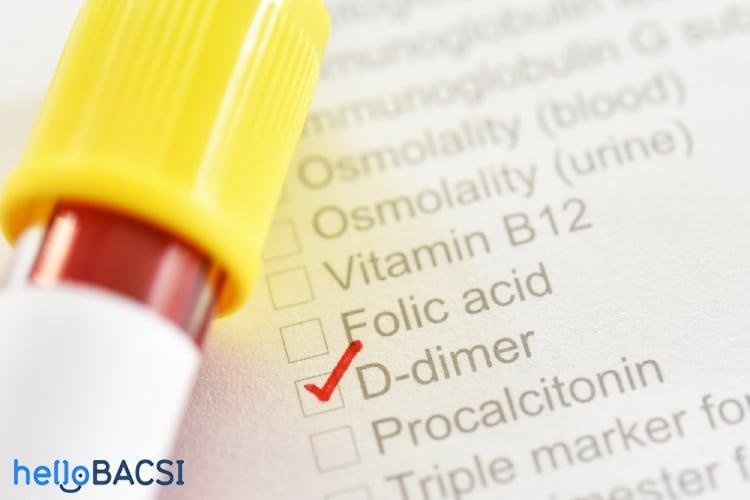 Xét nghiệm D-dimer