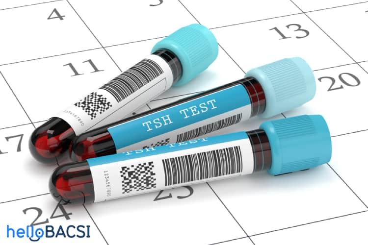 Xét nghiệm hormone kích thích tuyến giáp