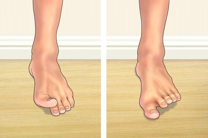 bác sĩ chấn thương chỉnh hình hướng dẫn tập yoga cho chân