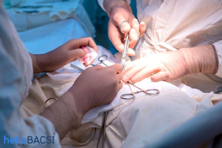 Cắt bỏ lá lách