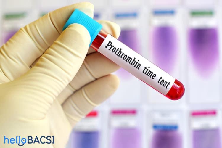 Xét nghiệm đo thời gian prothrombin