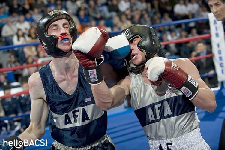 Cách phòng tránh hiện tượng chảy máu mũi có cục máu đông