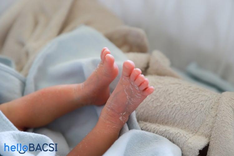 Hội chứng bong vảy da do tụ cầu