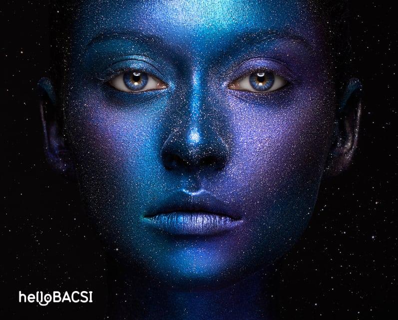 Hội chứng xanh tím da