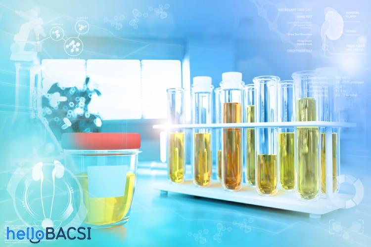 Định lượng protein niệu