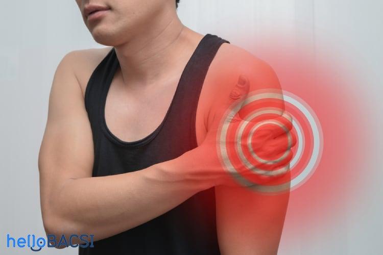 Rách cơ tam đầu cánh tay