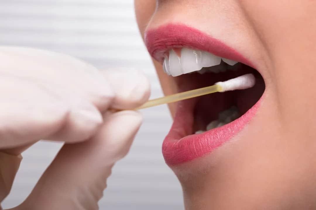 lấy mẫu niêm mạc thành má trong để xét nghiệm di truyền