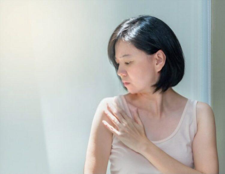 chàm là bệnh da liễu thường gặp vào mùa nóng