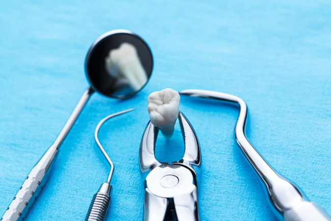 Mất răng lâu năm có trồng lại được không?