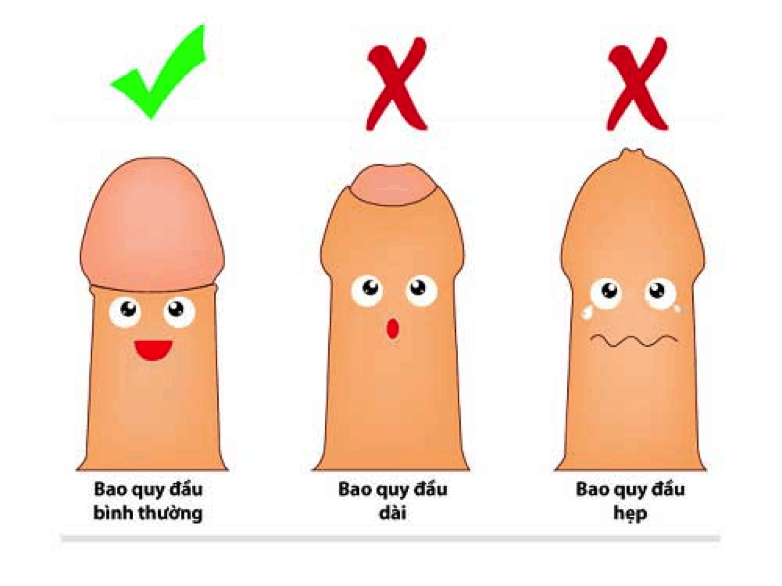 Bao quy đầu dài có nên cắt không? Cắt bao quy đầu ở đâu?