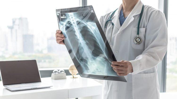 chẩn đoán tắc nghẽn phổi mạn tính