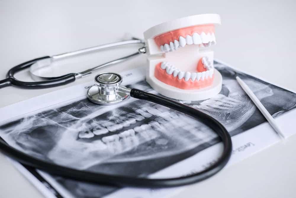 Nhổ răng số 8 gây ra biến chứng gì? Tổng hợp địa điểm nhổ răng uy tín