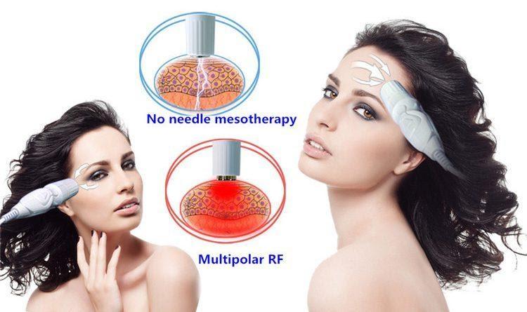 Công nghệ làm đẹp da mesotherapy là gì?